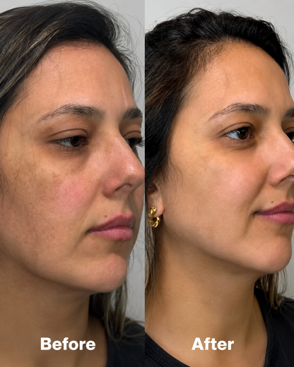 ARCFIT™ V-SHAPED JAWLINER